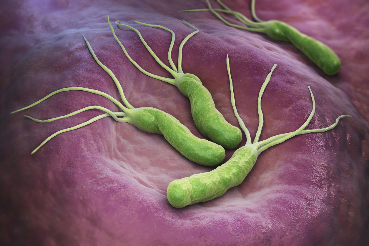 helicobacter pylori | DivaHair.ro